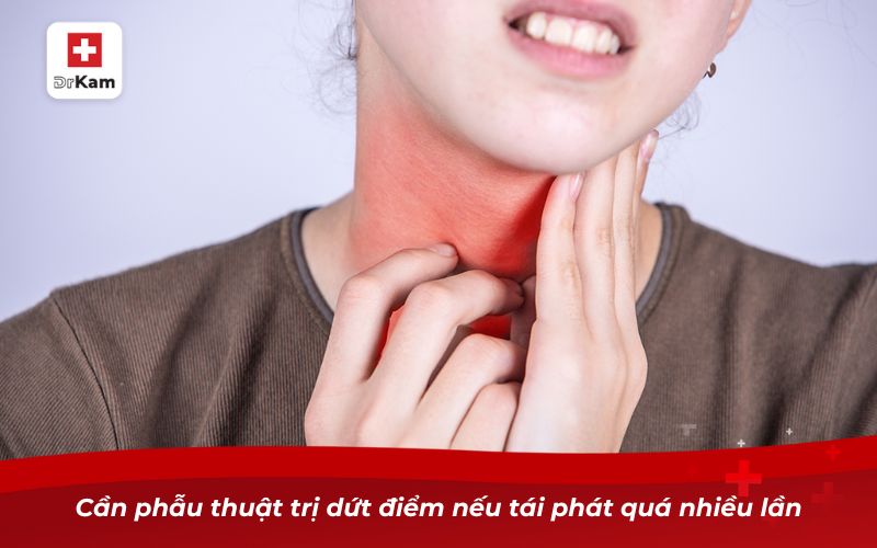 Viêm amidan hốc mủ bao lâu thì khỏi hoàn toàn? 9 Cần phẫu thuật trị dứt điểm nếu tái phát quá nhiều lần