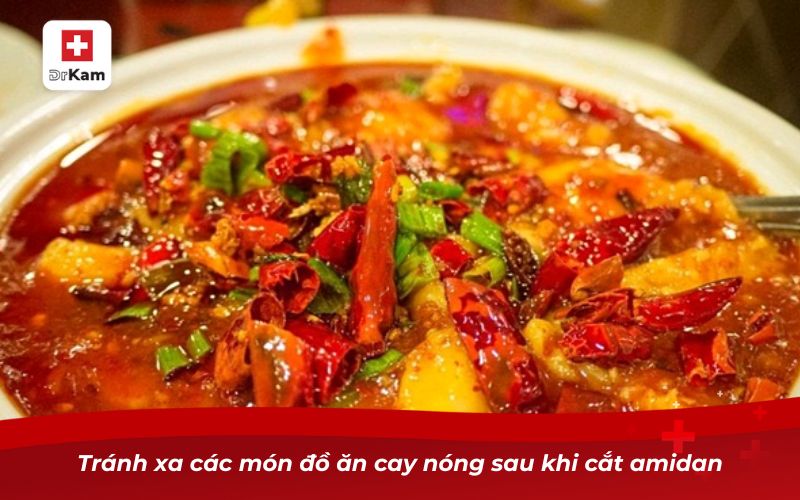 Người Bị Viêm Amidan Hốc Mủ Có Nên Cắt Không? 10 Tránh xa các món đồ ăn cay nóng sau khi cắt amidan