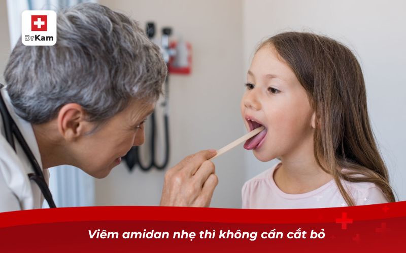 Viêm amidan nhẹ thì không cần cắt bỏ