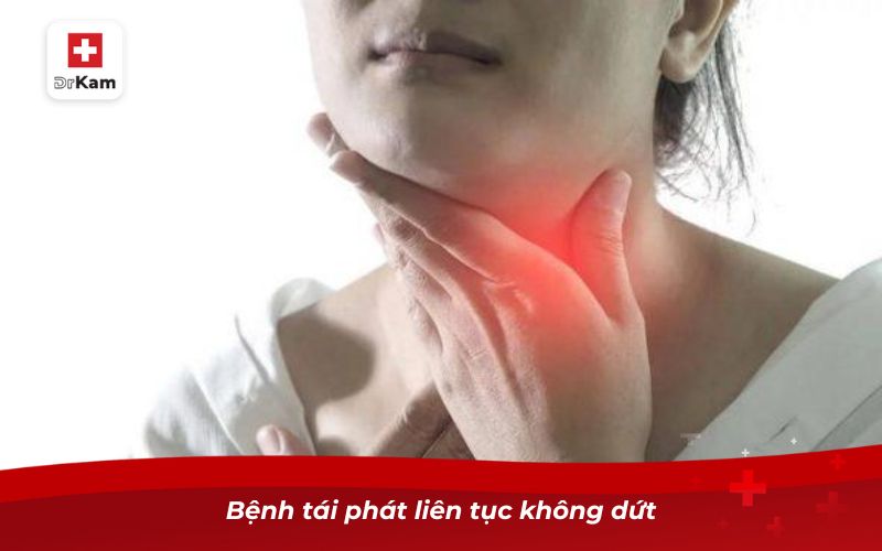Viêm họng kéo dài và những điều cần biết để bảo vệ sức khỏe 8 Bệnh tái phát liên tục không dứt