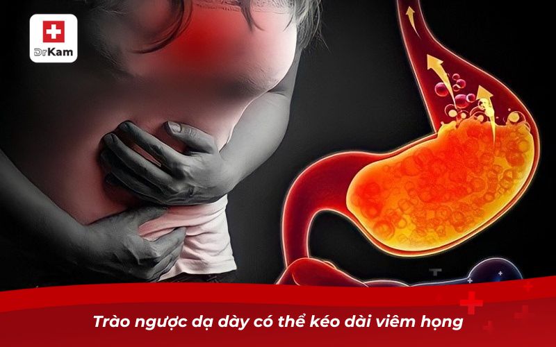Viêm họng kéo dài và những điều cần biết để bảo vệ sức khỏe 9 Trào ngược dạ dày có thể kéo dài viêm họng