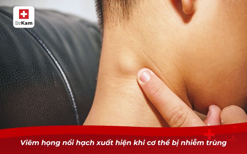 Hướng dẫn nhận biết viêm họng nổi hạch ở cổ 8 Viêm họng nổi hạch xuất hiện khi cơ thể bị nhiễm trùng