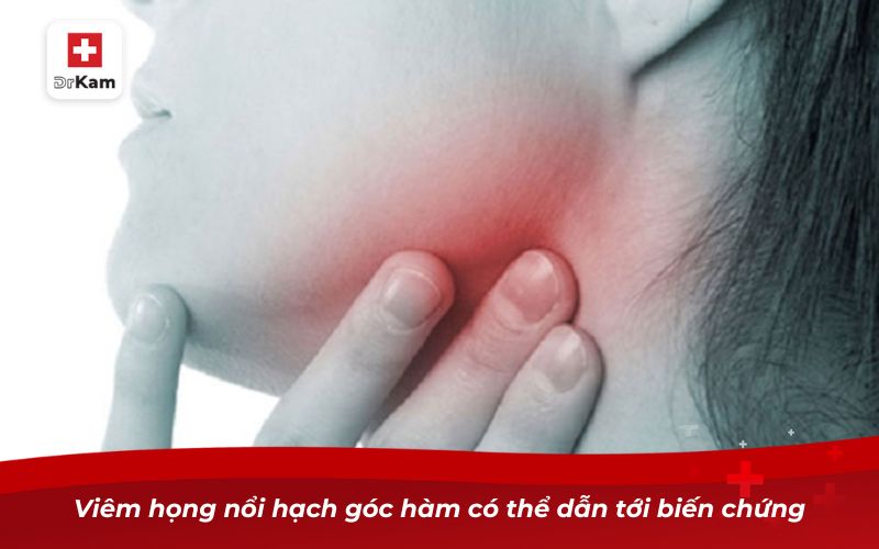 Hướng dẫn nhận biết viêm họng nổi hạch ở cổ 9 Viêm họng nổi hạch góc hàm có thể dẫn tới biến chứng