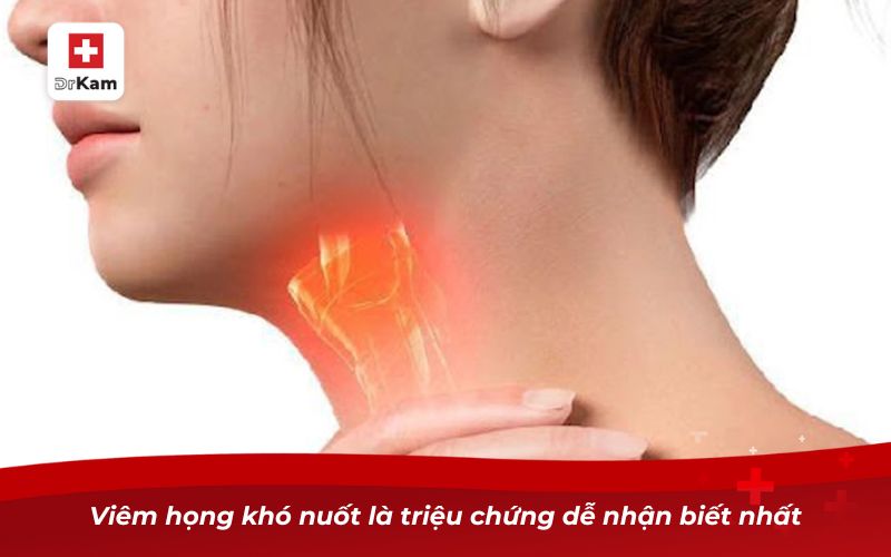 Hướng dẫn nhận biết viêm họng nổi hạch ở cổ 12 Viêm họng khó nuốt là triệu chứng dễ nhận biết nhất