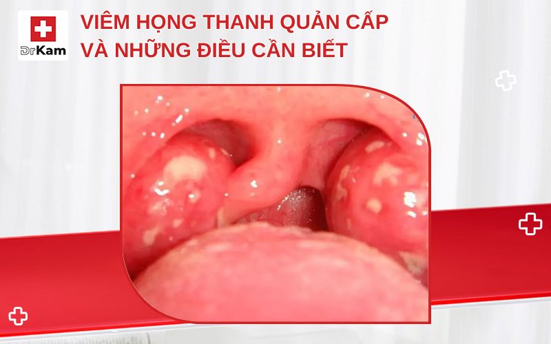 viem hong thanh quan cap thumbnail