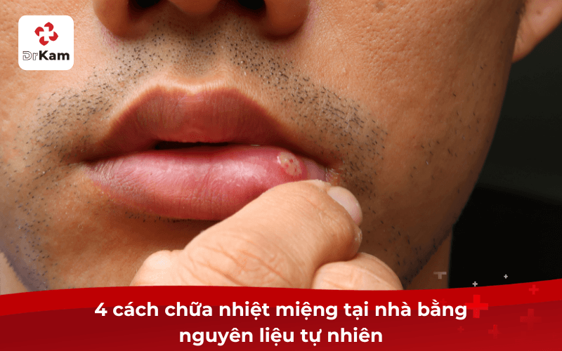 Cách chữa nhiệt miệng tại nhà đơn giản hiệu quả 5 4 cách chữa nhiệt miệng tại nhà bằng nguyên liệu tự nhiên