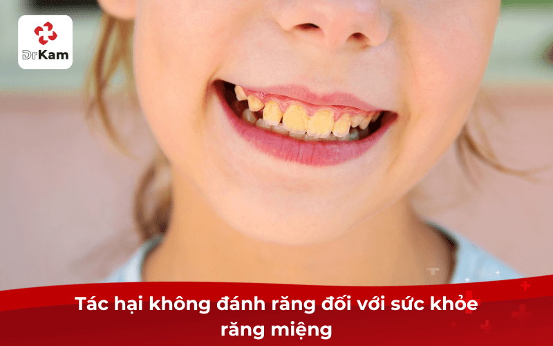 15 Tác hại không đánh răng nguy hiểm đến sức khỏe răng miệng và toàn thân cần biết 4 Tác hại không đánh răng đối với sức khỏe răng miệng