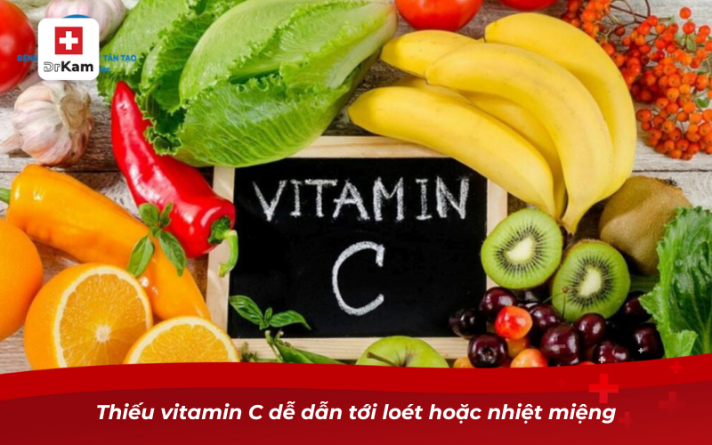 Bị nhiệt miệng thiếu vitamin gì? Nguyên nhân và cách bổ sung 7 Thiếu vitamin C dễ dẫn tới loét hoặc nhiệt miệng