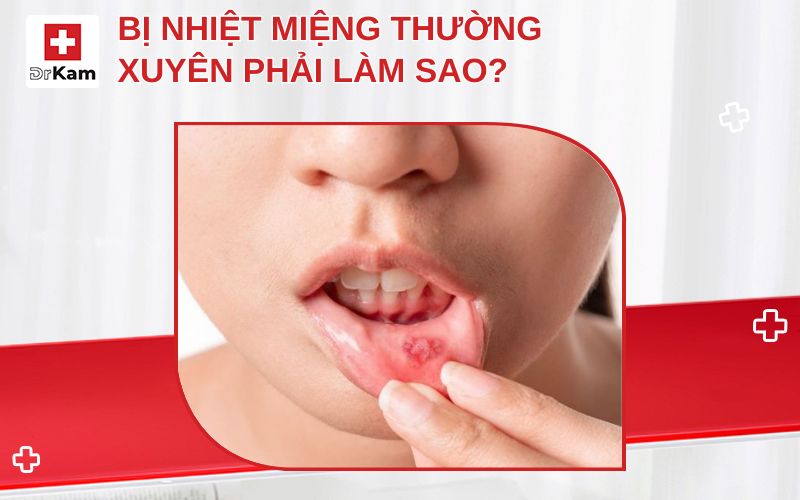 bi nhiet mieng thuong xuyen thumbnail