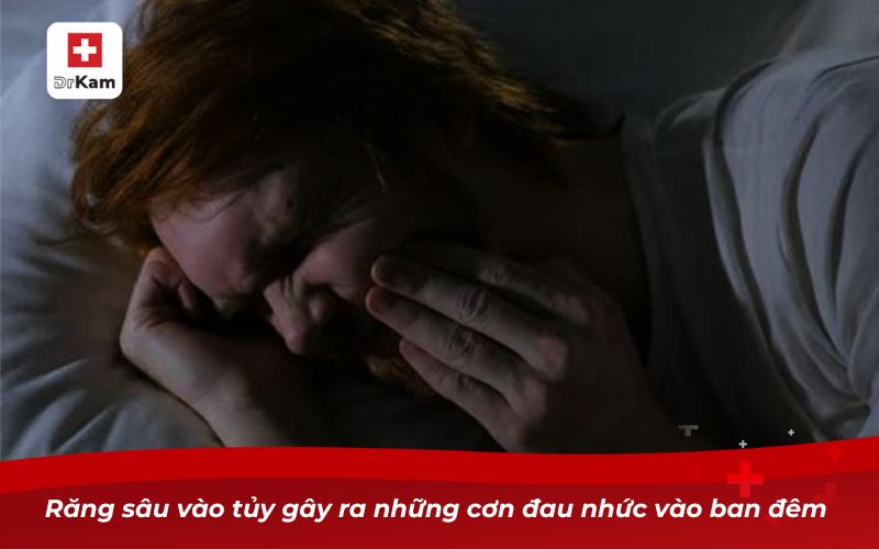 Răng sâu vào tủy gây ra những cơn đau nhức vào ban đêm 