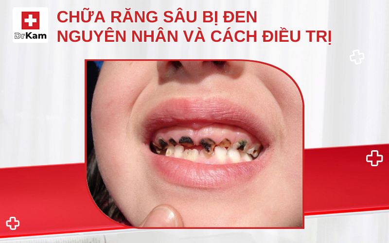 chua rang sau bi den thumbnail