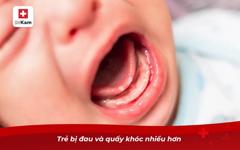 Trẻ bị đau và quấy khóc nhiều hơn 