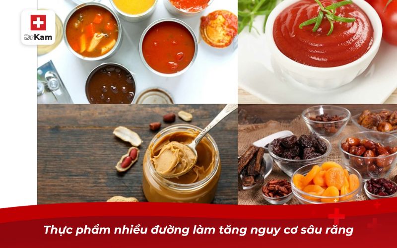 Nguyên nhân gây sâu răng và những điều bạn cần biết 7 Thực phẩm nhiều đường làm tăng nguy cơ sâu răng