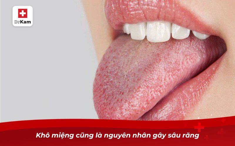 Nguyên nhân gây sâu răng và những điều bạn cần biết 9 Khô miệng cũng là nguyên nhân gây sâu răng
