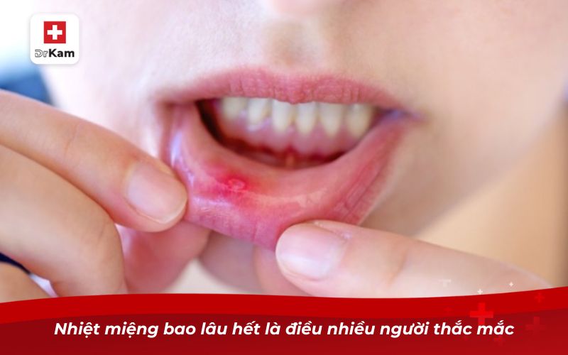 Nhiệt miệng bao lâu hết là điều nhiều người thắc mắc