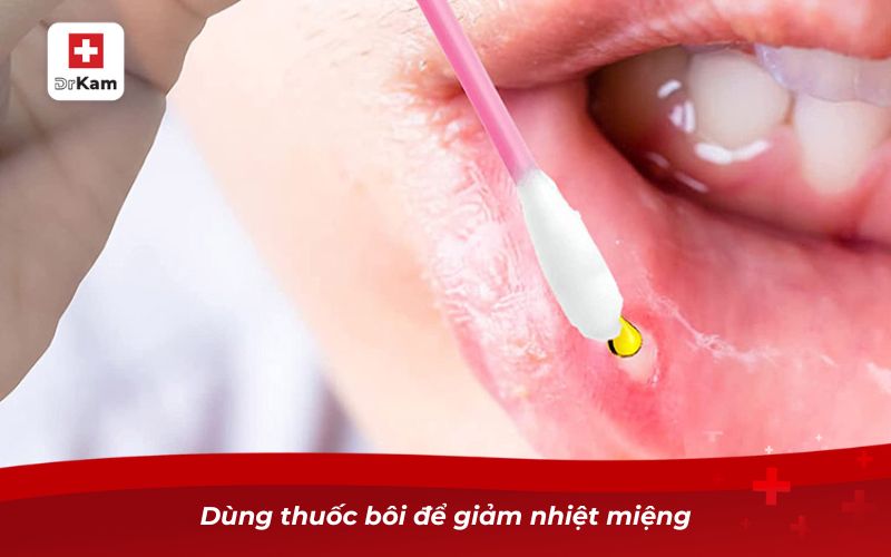 Dùng thuốc bôi để giảm nhiệt miệng