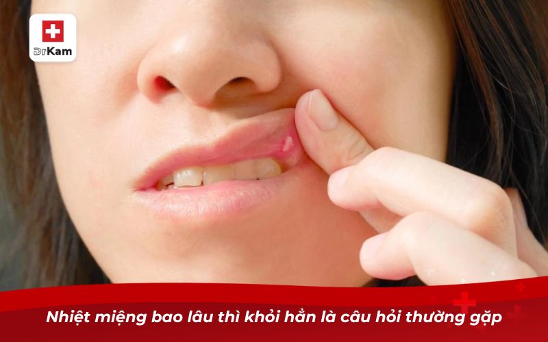Nhiệt miệng bao lâu thì khỏi? Nguyên nhân và lưu ý cụ thể 7 Nhiệt miệng bao lâu thì khỏi hẳn là câu hỏi thường gặp