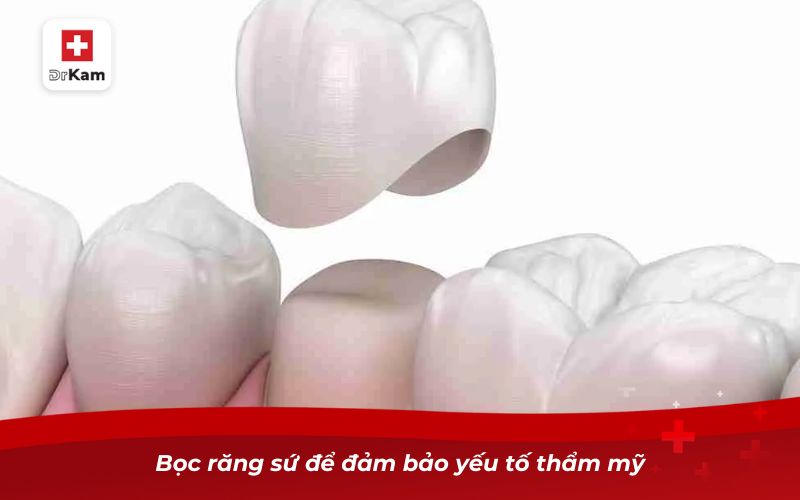 Răng bị sâu lỗ to phải làm sao? Giải pháp dứt điểm hiệu quả 11 Bọc răng sứ để đảm bảo yếu tố thẩm mỹ