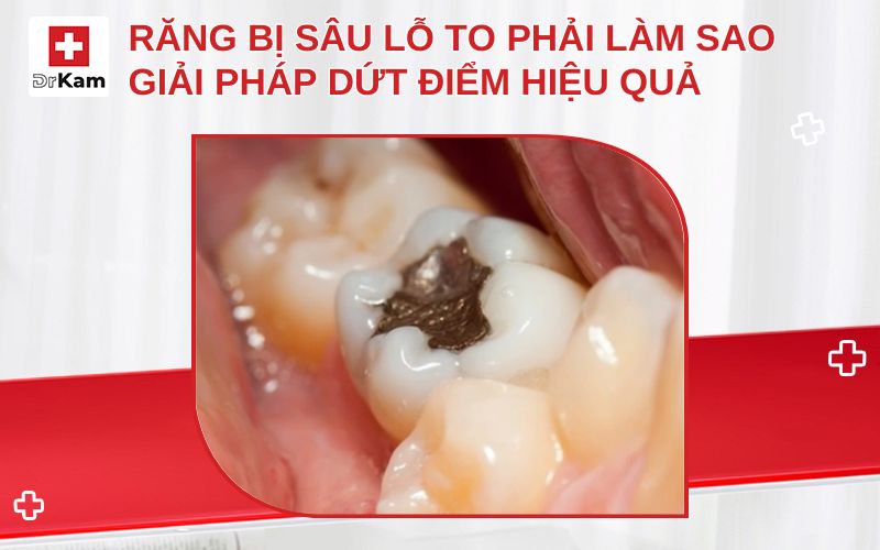 rang bi sau lo to phai lam sao thumbnail