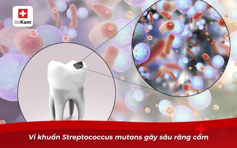 Răng Cấm Bị Sâu - Nguyên Nhân, Triệu Chứng Và Cách Xử Lý 11 Vi khuẩn Streptococcus mutans gây sâu răng cấm
