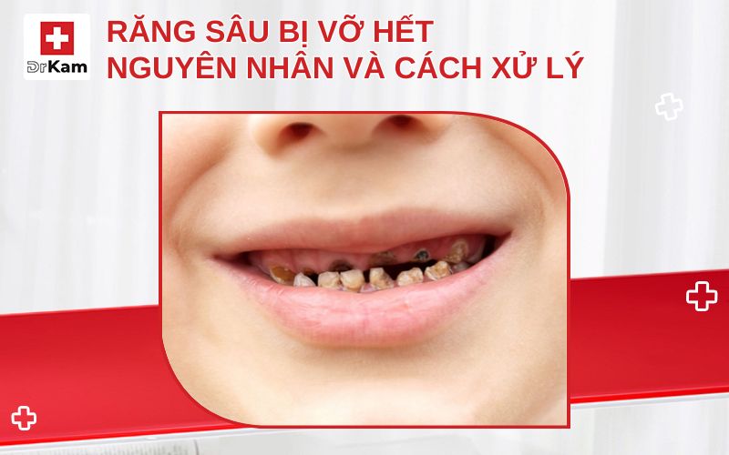 rang sau bi vo het thumbnail