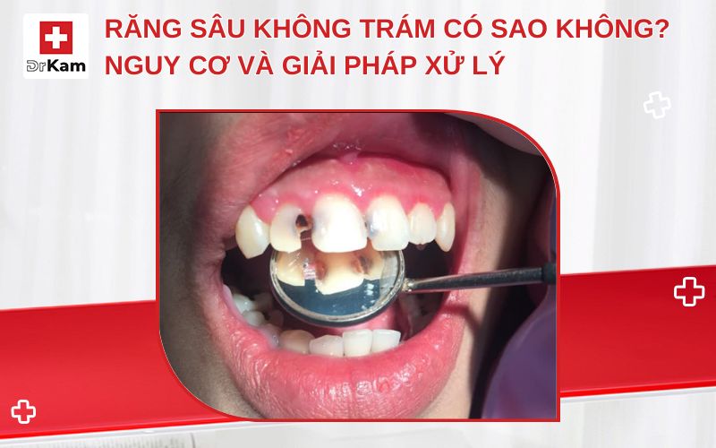 rang sau khong tram co sao khong thumbnail