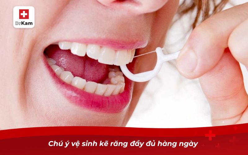 Sâu kẽ răng - Hướng dẫn nhận biết và điều trị triệt để 8 Chú ý vệ sinh kẽ răng đầy đủ hàng ngày