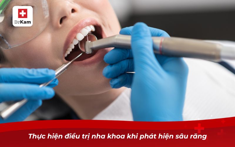 Sâu răng để lâu có sao không? Tìm hiểu ngay! 13 Thực hiện điều trị nha khoa khi phát hiện sâu răng