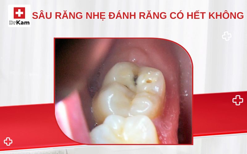 sau rang nhe danh rang co het khong thumbnail
