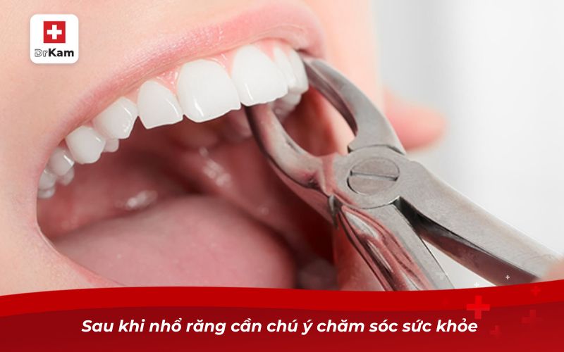 Tác hại của việc không nhổ răng sâu và cách khắc phục 11 Sau khi nhổ răng cần chú ý chăm sóc sức khỏe