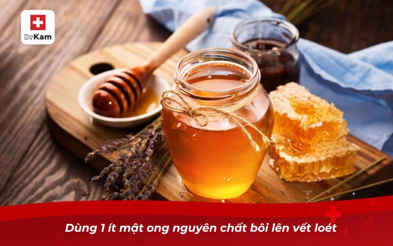 Trẻ em bị nhiệt miệng - Nguyên nhân và cách điều trị cấp tốc 10 Dùng 1 ít mật ong nguyên chất bôi lên vết loét