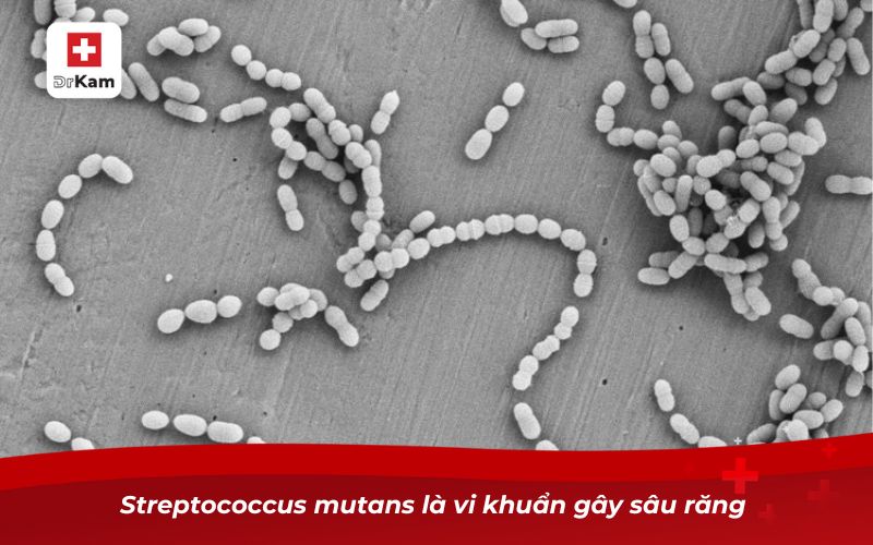 Streptococcus mutans là vi khuẩn gây sâu răng 