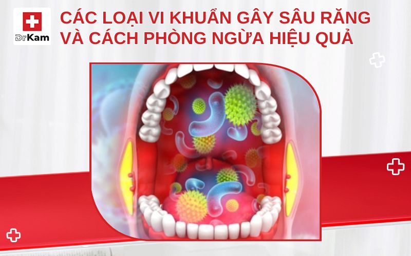 vi khuan sau rang thumbnail