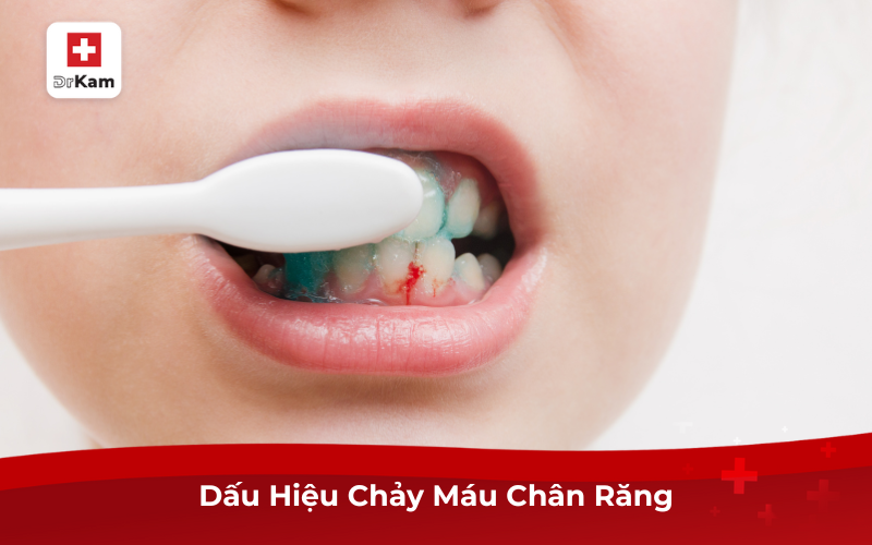 Dấu hiệu chảy máu chân răng