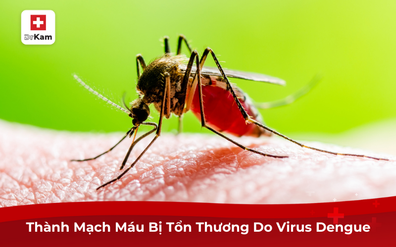 Nguyên Nhân, Cách Điều Trị Sốt Xuất Huyết Chảy Máu Chân Răng 7 Thành Mạch Máu Bị Tổn Thương Do Virus Dengue