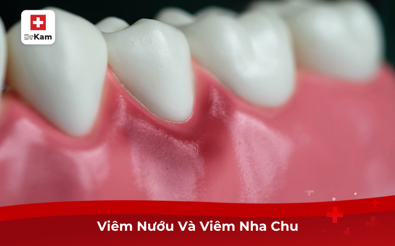 Nguyên Nhân, Cách Điều Trị Chảy Máu Chân Răng Khi Đánh Răng 7 Viêm Nướu Và Viêm Nha Chu