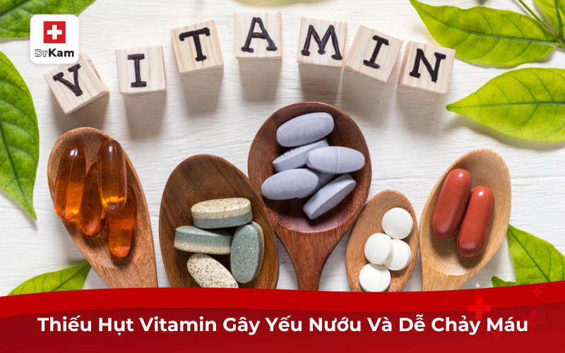 Tự Nhiên Chảy Máu Chân Răng Là Bệnh Gì? Cách Điều Trị 7 Thiếu Hụt Vitamin Gây Yếu Nướu Và Dễ Chảy Máu