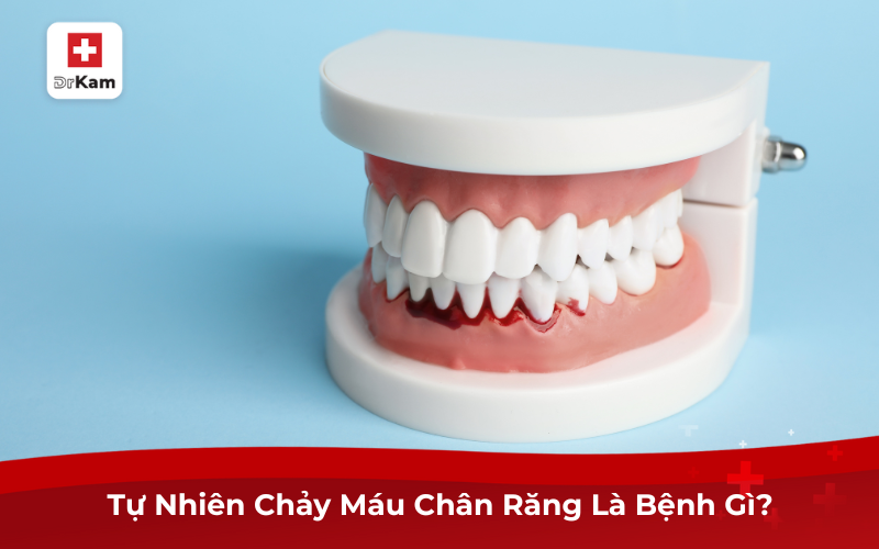 Tự Nhiên Chảy Máu Chân Răng Là Bệnh Gì? Cách Điều Trị 8 Tự Nhiên Chảy Máu Chân Răng Là Bệnh Gì?