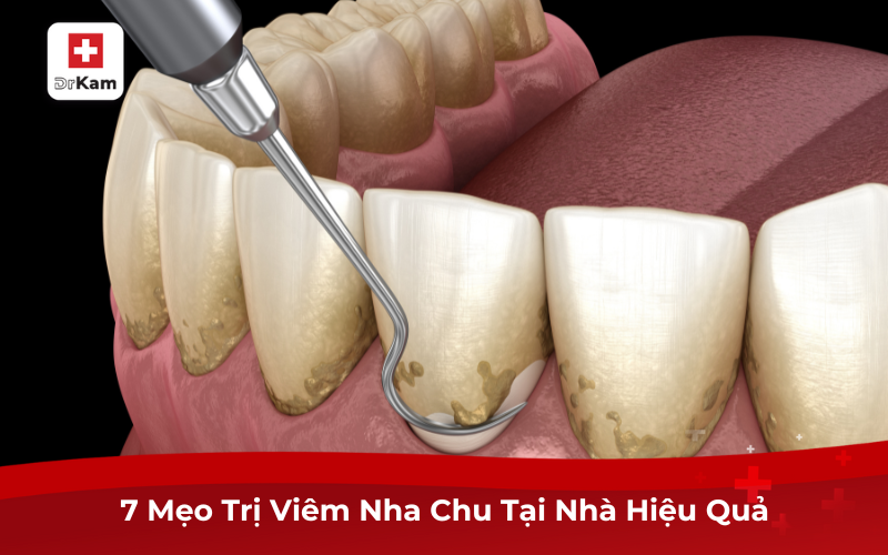7 Mẹo Trị Viêm Nha Chu Tại Nhà Hiệu Quả