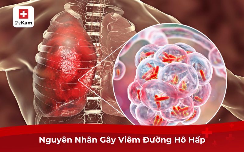 Viêm Đường Hô Hấp Là Gì? Nguyên Nhân, Cách Điều Trị 7 Nguyên Nhân Gây Viêm Đường Hô Hấp