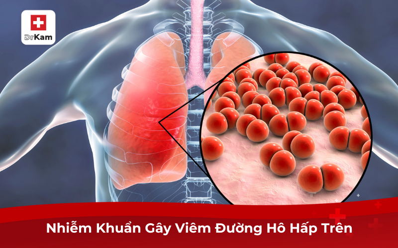 Tìm Hiểu Viêm Đường Hô Hấp Trên Là Gì Và Cách Điều Trị 7 Nhiễm Khuẩn Gây Viêm Đường Hô Hấp Trên