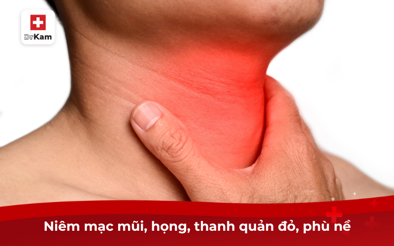 Tìm Hiểu Hội Chứng Viêm Long Đường Hô Hấp Trên 8 Niêm mạc mũi, họng, thanh quản đỏ, phù nề