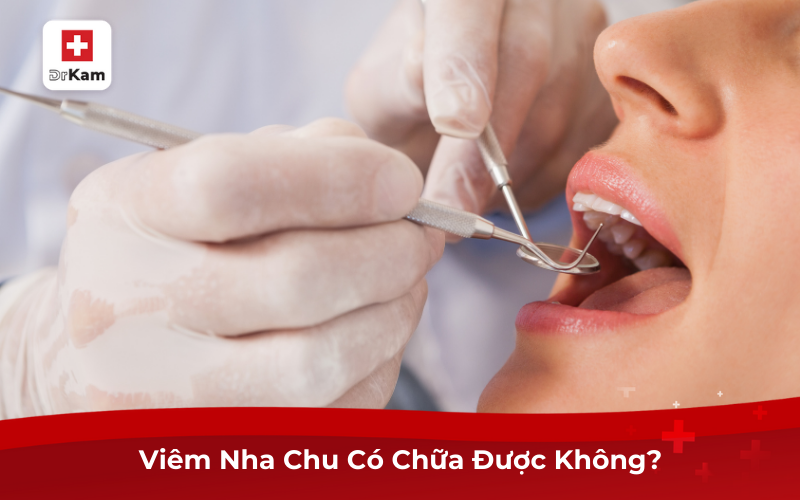 Bệnh Viêm Nha Chu Có Chữa Được Không? Chữa Thế Nào? 7 Viêm Nha Chu Có Chữa Được Không?