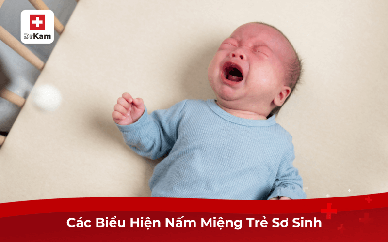 Phòng Ngừa Và Điều Trị Dứt Điểm Nấm Miệng Trẻ Sơ Sinh 7 Các Biểu Hiện Nấm Miệng Trẻ Sơ Sinh