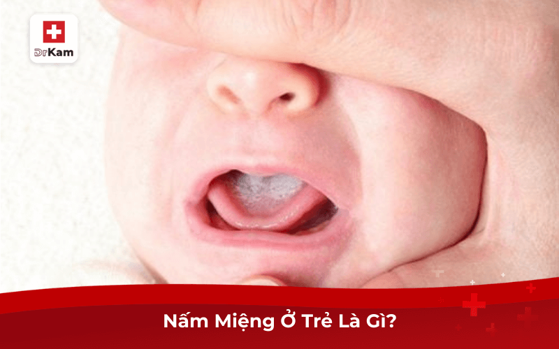 Dấu Hiệu Trẻ Bị Nấm Miệng Và Cách Điều Trị Hiệu Quả 8 Nấm Miệng Ở Trẻ Là Gì?