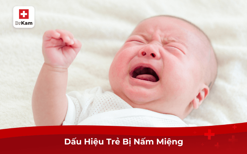 Dấu Hiệu Trẻ Bị Nấm Miệng Và Cách Điều Trị Hiệu Quả 9 Dấu Hiệu Trẻ Bị Nấm Miệng