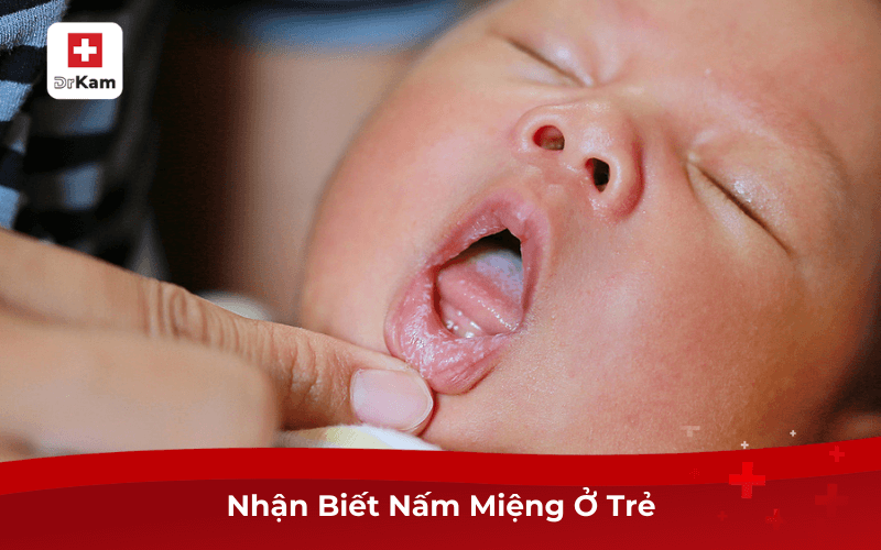 Nhận Biết Nấm Miệng Ở Trẻ