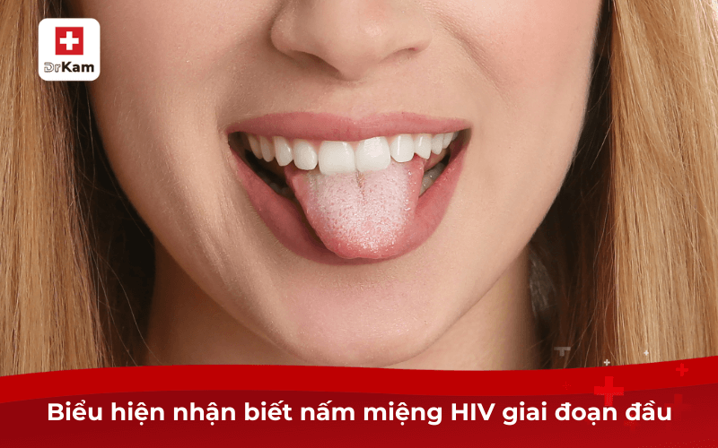 Nấm miệng hiv giai đoạn đầu: Biểu hiện, cách phòng ngừa 7 Biểu hiện nhận biết nấm miệng HIV giai đoạn đầu