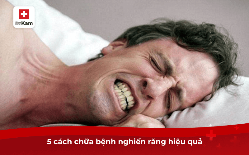 5 cách chữa bệnh nghiến răng hiệu quả