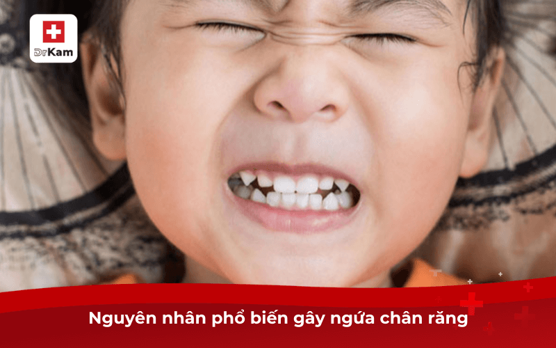 Nguyên nhân phổ biến gây ngứa chân răng